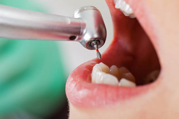 Best Pediatric Emergency Dentist in Footville, WI